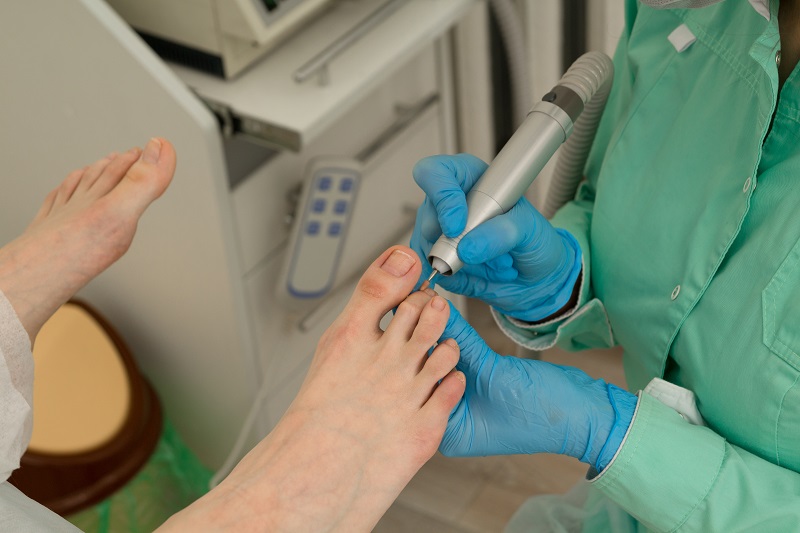 Ingrown Toenail Clinic