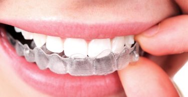 Can Treatment Using Invisalign Reshape a Crooked Smile?