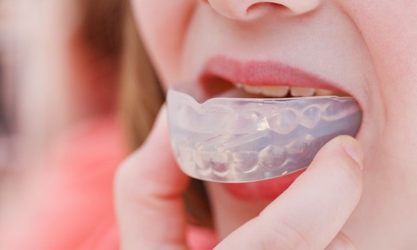 Choosing the Right Mouthguard