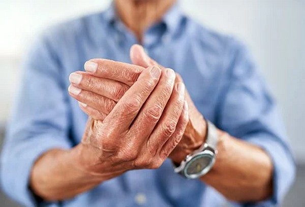 How to treat arthritis