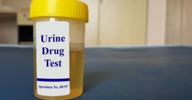 How To Prepare for a Pre-Employment Drug Test