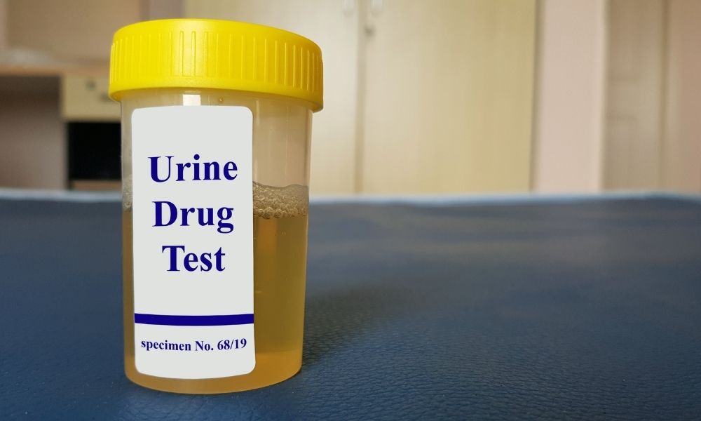 How To Prepare for a Pre-Employment Drug Test