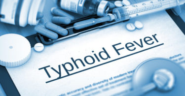 Typhoid-fever