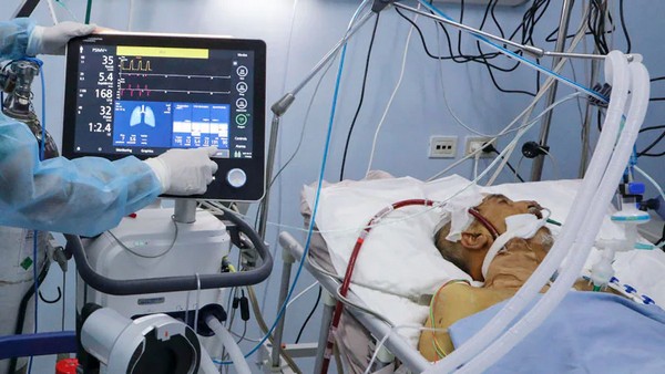 ECMO Treatment