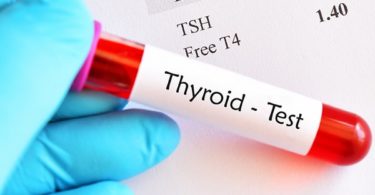 Thyroid blood test