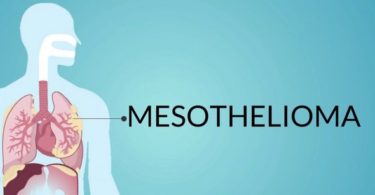 Mesothelioma