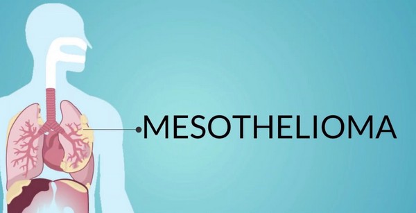 Mesothelioma