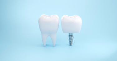 dental crowns