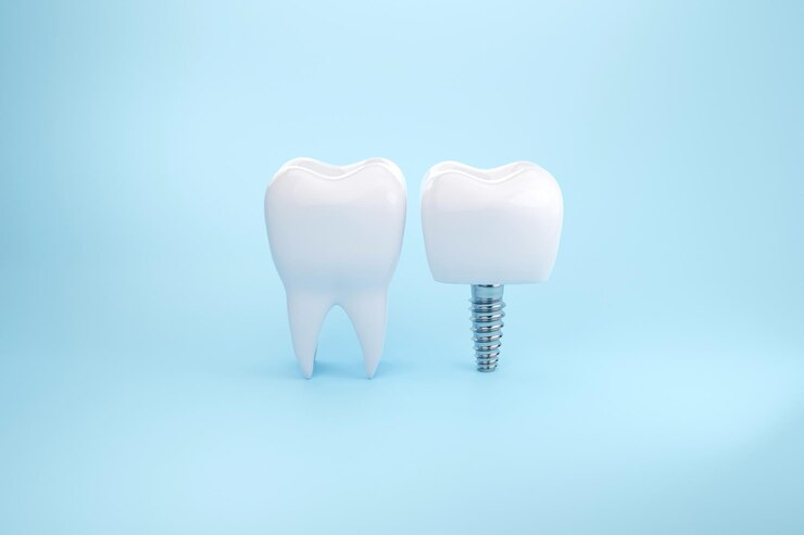 dental crowns