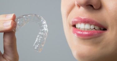 Invisalign tips