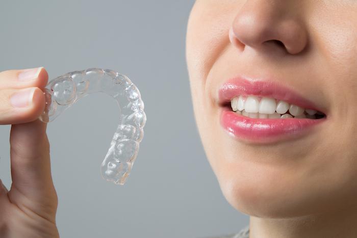 Invisalign tips