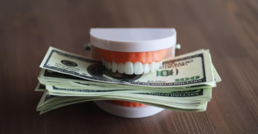 Cost of Dental Implants