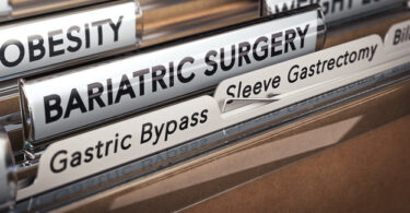 Bariatric Surgery